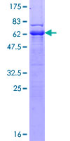 TTC1 Protein - 12.5% SDS-PAGE of human TTC1 stained with Coomassie Blue