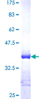 TTC1 Protein - 12.5% SDS-PAGE Stained with Coomassie Blue