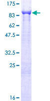 TTC12 Protein - 12.5% SDS-PAGE of human TTC12 stained with Coomassie Blue
