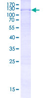 TTC14 Protein - 12.5% SDS-PAGE Stained with Coomassie Blue