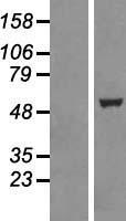 TTC19 Protein - Western validation with an anti-DDK antibody * L: Control HEK293 lysate R: Over-expression lysate