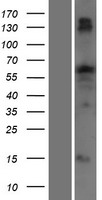 TTC22 Protein - Western validation with an anti-DDK antibody * L: Control HEK293 lysate R: Over-expression lysate