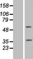 TTC23 Protein - Western validation with an anti-DDK antibody * L: Control HEK293 lysate R: Over-expression lysate