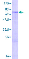 TTC23 Protein - 12.5% SDS-PAGE of human TTC23 stained with Coomassie Blue
