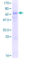 TTC23L / FLJ25439 Protein - 12.5% SDS-PAGE of human FLJ25439 stained with Coomassie Blue