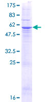 TTC26 Protein - 12.5% SDS-PAGE of human TTC26 stained with Coomassie Blue