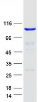 TTC27 Protein - Purified recombinant protein TTC27 was analyzed by SDS-PAGE gel and Coomassie Blue Staining