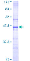 TTC3 Protein - 12.5% SDS-PAGE Stained with Coomassie Blue.
