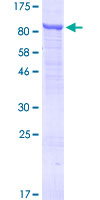 TTC30A Protein - 12.5% SDS-PAGE of human TTC30A stained with Coomassie Blue