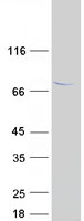 TTC30A Protein - Purified recombinant protein TTC30A was analyzed by SDS-PAGE gel and Coomassie Blue Staining