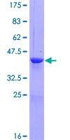 TTC32 Protein - 12.5% SDS-PAGE of human LOC130502 stained with Coomassie Blue