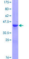 TTC32 Protein - 12.5% SDS-PAGE of human LOC130502 stained with Coomassie Blue