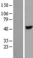 TTC38 Protein - Western validation with an anti-DDK antibody * L: Control HEK293 lysate R: Over-expression lysate