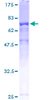 TTC38 Protein - 12.5% SDS-PAGE of human FLJ20699 stained with Coomassie Blue