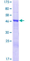 TTC39A Protein - 12.5% SDS-PAGE of human C1orf34 stained with Coomassie Blue