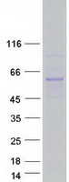 TTC39B Protein - Purified recombinant protein TTC39B was analyzed by SDS-PAGE gel and Coomassie Blue Staining