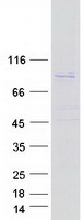 TTC39B Protein - Purified recombinant protein TTC39B was analyzed by SDS-PAGE gel and Coomassie Blue Staining