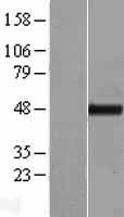 TTC4 Protein - Western validation with an anti-DDK antibody * L: Control HEK293 lysate R: Over-expression lysate