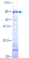 TTC4 Protein - 12.5% SDS-PAGE of human TTC4 stained with Coomassie Blue
