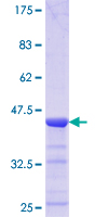 TTC4 Protein - 12.5% SDS-PAGE Stained with Coomassie Blue.