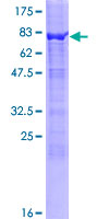 TTC5 Protein - 12.5% SDS-PAGE of human TTC5 stained with Coomassie Blue