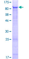 TTC6 Protein - 12.5% SDS-PAGE of human TTC6 stained with Coomassie Blue