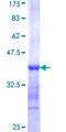 TTC8 Protein - 12.5% SDS-PAGE Stained with Coomassie Blue.