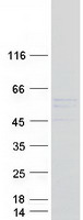 TTC8 Protein - Purified recombinant protein TTC8 was analyzed by SDS-PAGE gel and Coomassie Blue Staining