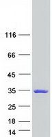 TTC9 Protein - Purified recombinant protein TTC9 was analyzed by SDS-PAGE gel and Coomassie Blue Staining