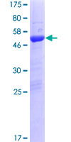 TTC9B Protein - 12.5% SDS-PAGE of human TTC9B stained with Coomassie Blue