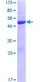 TTC9B Protein - 12.5% SDS-PAGE of human TTC9B stained with Coomassie Blue