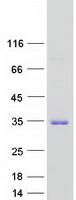 TTC9B Protein - Purified recombinant protein TTC9B was analyzed by SDS-PAGE gel and Coomassie Blue Staining