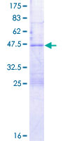 TTDN1 Protein - 12.5% SDS-PAGE of human C7orf11 stained with Coomassie Blue