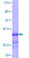 TTDN1 Protein - 12.5% SDS-PAGE Stained with Coomassie Blue.