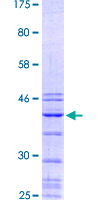 TTF1 / Txn Termination Factor Protein - 12.5% SDS-PAGE Stained with Coomassie Blue.