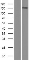 TTF2 / HuF2 Protein - Western validation with an anti-DDK antibody * L: Control HEK293 lysate R: Over-expression lysate
