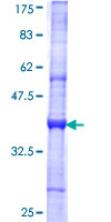 TTL Protein - 12.5% SDS-PAGE Stained with Coomassie Blue.