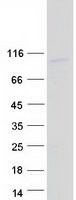 TTLL11 Protein - Purified recombinant protein TTLL11 was analyzed by SDS-PAGE gel and Coomassie Blue Staining