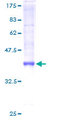 TTLL3 Protein - 12.5% SDS-PAGE of human TTLL3 stained with Coomassie Blue