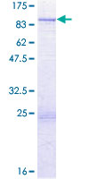 TTLL6 Protein - 12.5% SDS-PAGE of human TTLL6 stained with Coomassie Blue