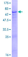 TTLL9 Protein - 12.5% SDS-PAGE of human TTLL9 stained with Coomassie Blue
