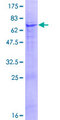 TTLL9 Protein - 12.5% SDS-PAGE of human TTLL9 stained with Coomassie Blue
