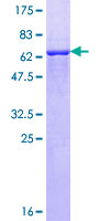 TTN / Titin Protein - 12.5% SDS-PAGE of human TTN stained with Coomassie Blue