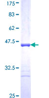 TTN / Titin Protein - 12.5% SDS-PAGE Stained with Coomassie Blue.