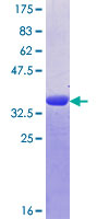 TTN / Titin Protein - 12.5% SDS-PAGE Stained with Coomassie Blue.