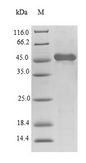 TTPA Protein - (Tris-Glycine gel) Discontinuous SDS-PAGE (reduced) with 5% enrichment gel and 15% separation gel.