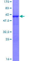 TTPA Protein - 12.5% SDS-PAGE of human TTPA stained with Coomassie Blue