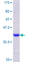 TTPA Protein - 12.5% SDS-PAGE Stained with Coomassie Blue.