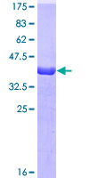 TTR / Transthyretin Protein - 12.5% SDS-PAGE of human TTR stained with Coomassie Blue