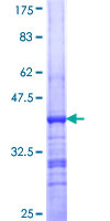 TUBA1A / Tubulin Alpha 1a Protein - 12.5% SDS-PAGE Stained with Coomassie Blue
